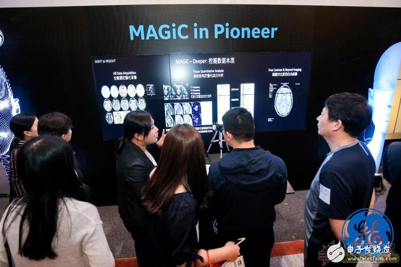 The first multi-contrast quantitative mapping magnetic resonance imaging technology MAGiC officially launched in China