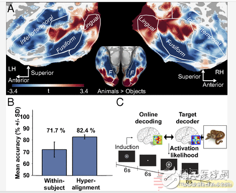 Scientists design functional magnetic resonance imaging to treat phobia