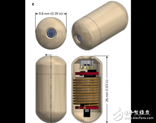 Electronic pill, the first real fart detector