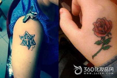Tattoo repair burning skin cleaning damage