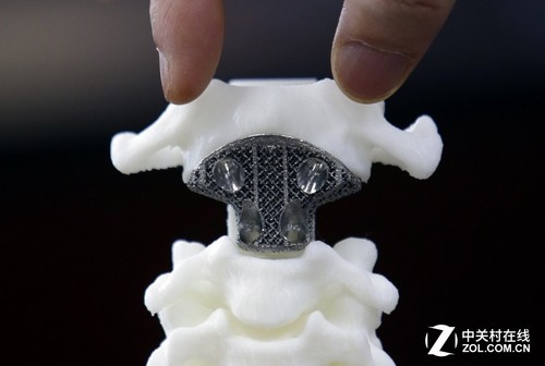 Why is 3D printing the life-saving straw on the operating table?