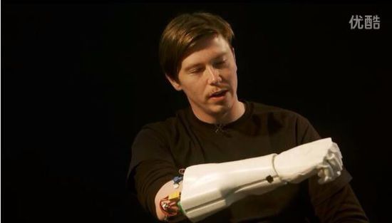 Cool! 3D printing "killing the encirclement" bionic artificial arm