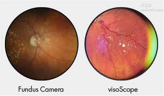 Economical and convenient 3D printing eye examination tools officially listed