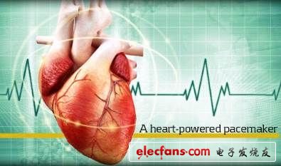 The United States developed a heart rate regulator for heartbeat power supply, which was originally used in unmanned aircraft