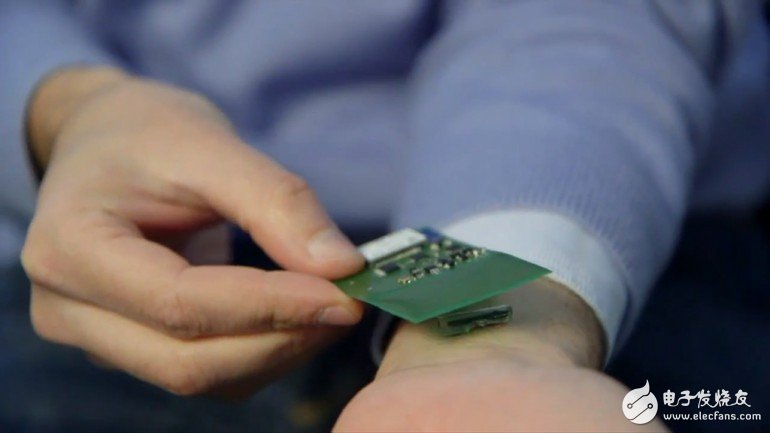 Wearable heart disease prevention chip, mobile phone predicts heart attack