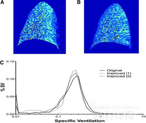 University of California develops 3D printed gas transmitter for pulmonary magnetic resonance