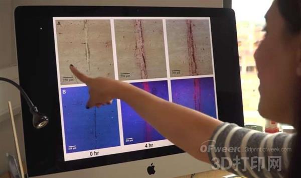 Does the combination of 3D scanning and gold represent the end of X-rays?