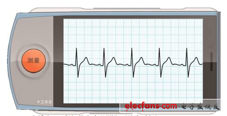 Dr. Heart? Remote Intelligent ECG Monitor (Health Phone)