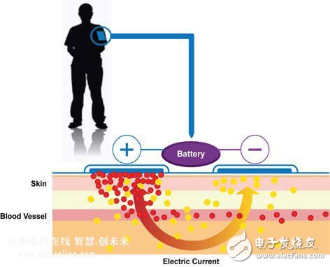 Figure 1: Typical iontophoresis process