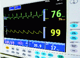 ECG and blood oxygen readings displayed on the patient monitor