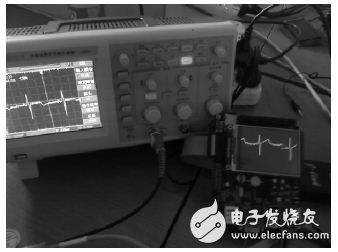 Design of an ECG Collector Based on STM32