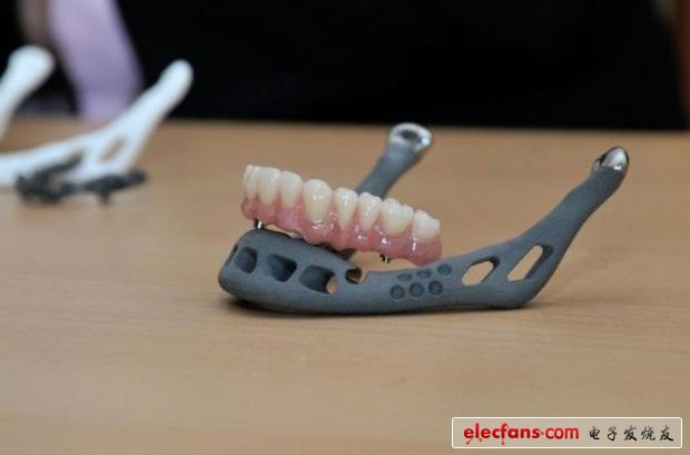 Application of 3D printing technology on teeth