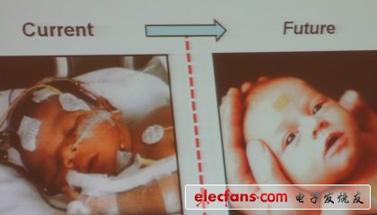 Figure 1 Future biological display suitable for premature newborns to replace implanted sensors