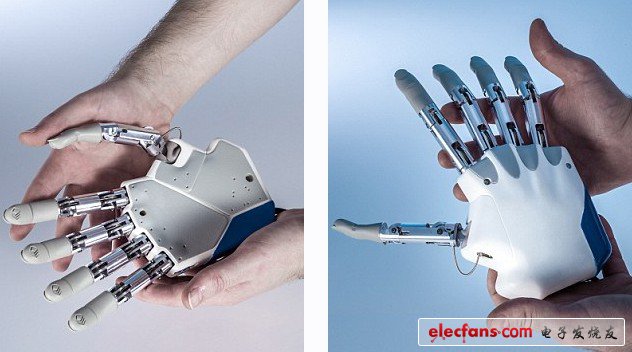 Figure 5 A patient about to undergo a bionic hand transplant operation, in his 20s, lost his hand in an accident