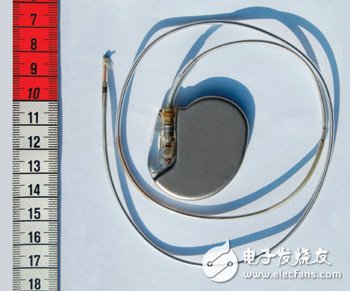 Implantable pacemakers (Figure 1) are usually light and small