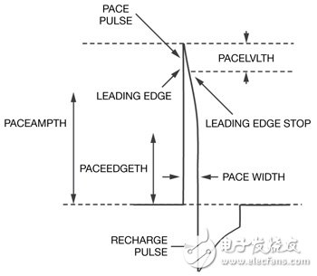 Figure 2 This is an example of an ideal pacing artifact. The positive pulse has a fast rising edge.