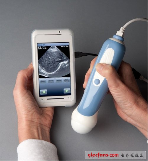 Pocket-sized ultrasound