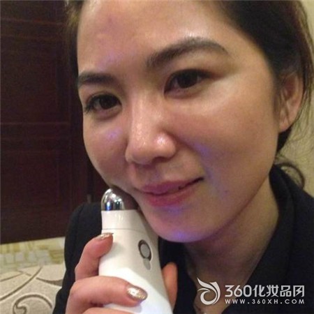 25-year-old skin show micro-current beauty instrument ShowYoung fade fine lines 3
