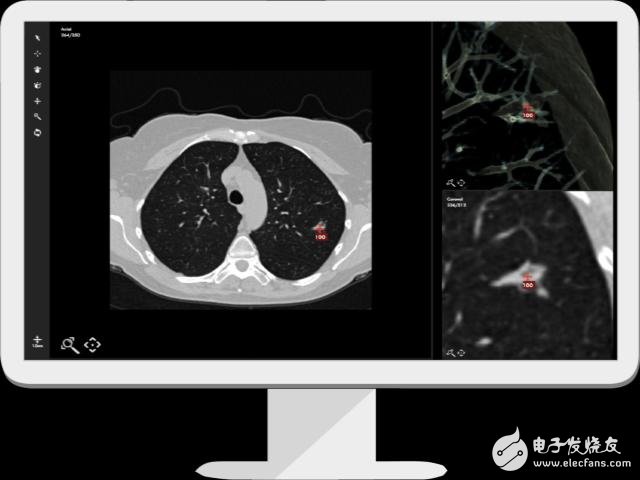 Predible Health: Providing treatment options for doctors with AI and cloud computing