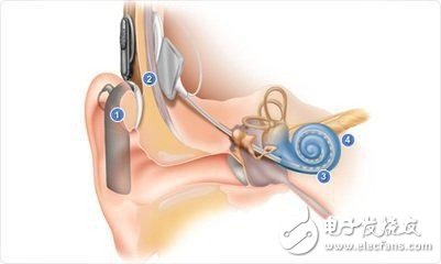 How can smart devices save our hearing step by step?