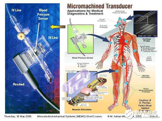 The main component of medical wearable smart devices: Picture of MEMS sensor