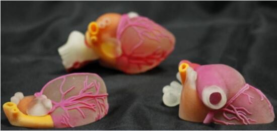 3D printing medical market is hot