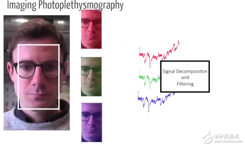 Cardiolens is a new method of measuring heart rate that can be used to detect a patient's heart rate with AR technology.