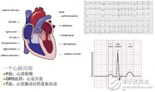 Simplify patient monitor design with ECG AFE