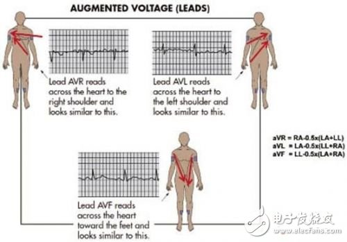 Simplify patient monitor design with ECG AFE