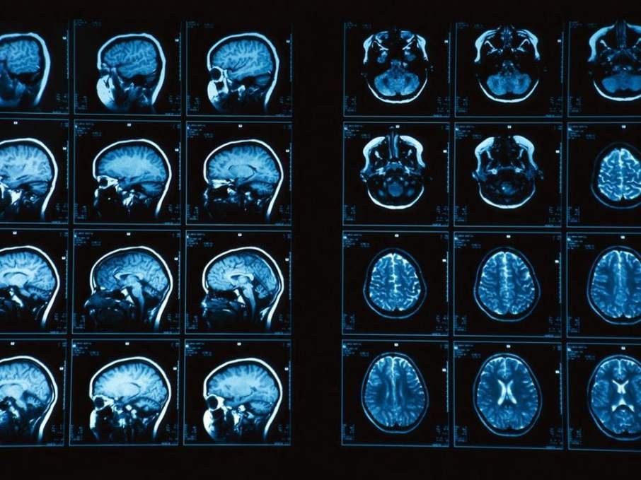 [Viewpoint] How does creating a 3D printed brain model affect medical care?