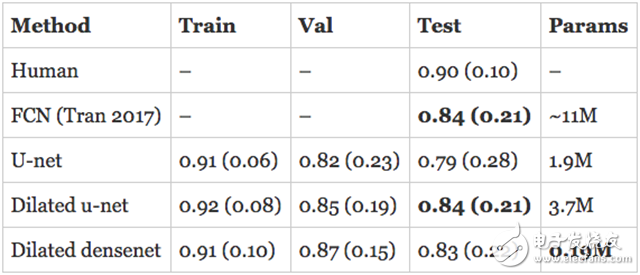 Deep learning how to perform right ventricular segmentation in MRI images