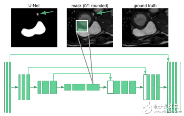 Deep learning how to perform right ventricular segmentation in MRI images