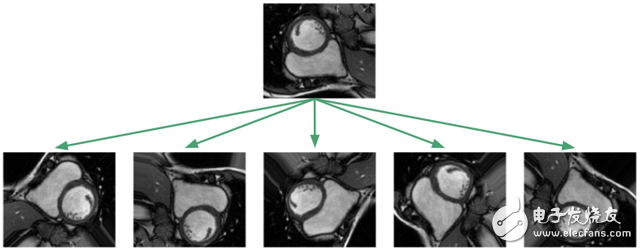 Deep learning how to perform right ventricular segmentation in MRI images