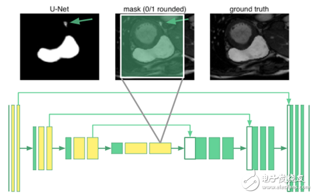 Deep learning how to perform right ventricular segmentation in MRI images