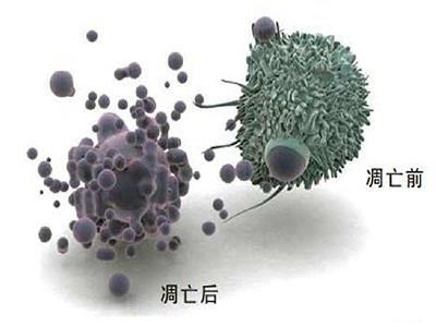 Cellé‡ç£…ç ”ç©¶|ç»†èƒžå…ç–«æ²»ç–—ä¸Žæ”¾ç–—è”ç”¨å°†ä½¿ä¸‡åƒç™Œç—‡æ‚£è€…å—ç›Šï¼