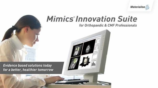 Materialise releases the latest version of Mimics, a medical 3D imaging software package