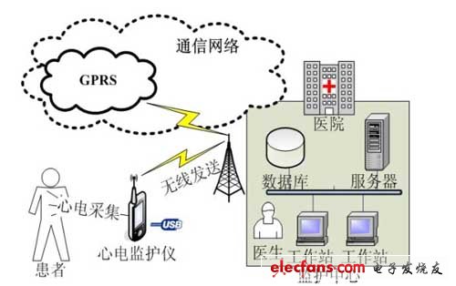 Overall block diagram of portable ECG monitoring system