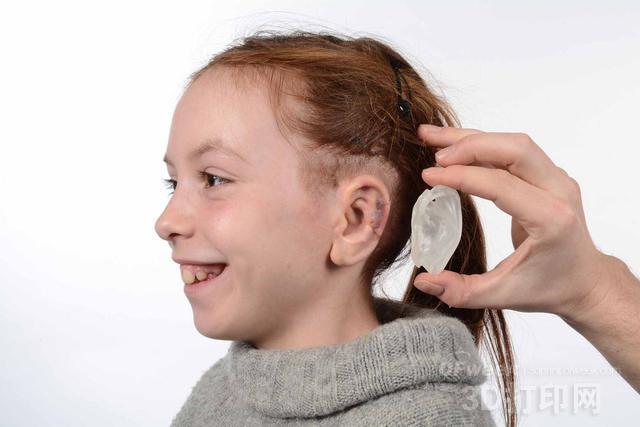 3D scan data helps medical artificial external ear to be more precise