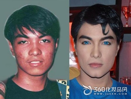 Men's 23 times cosmetic surgery idol Superman
