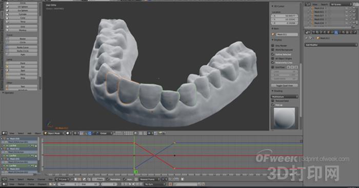 Universal 3D printing! Maker uses it at home DIY transparent braces