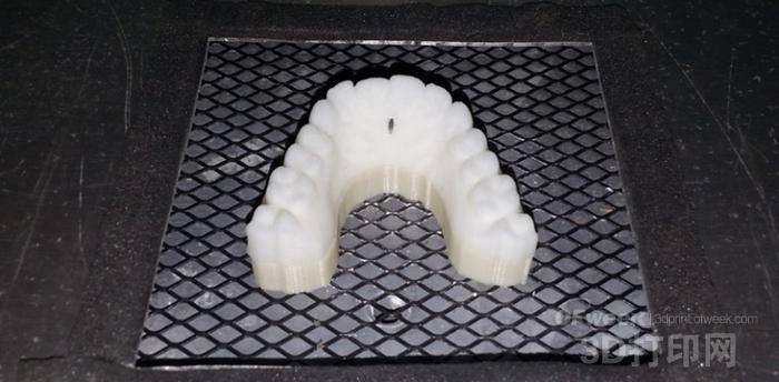 Universal 3D printing! Maker uses it at home DIY transparent braces