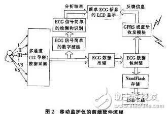 Design and Implementation of Remote ECG Monitoring Software System