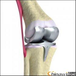 Artificial tibial tray assembly fatigue test