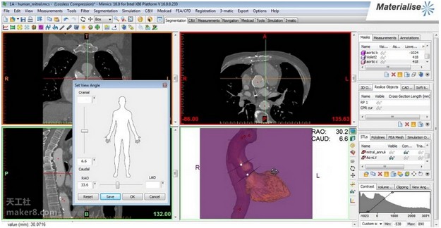 Canon will sell medical 3D printing solutions