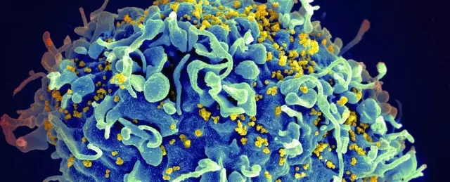 Natureï¼šç§‘å­¦å®¶å‘çŽ°æ ‡è®°HIVç—…æ¯’çš„æ–°æ–¹æ³•