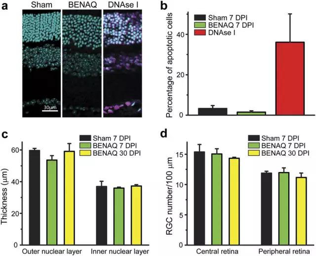 Natureï¼šæœ€æ–°åŒ–åˆç‰©å¯å¸®åŠ©å¤±æ˜Žè€é¼ æ¢å¤è§†è§‰å“åº”