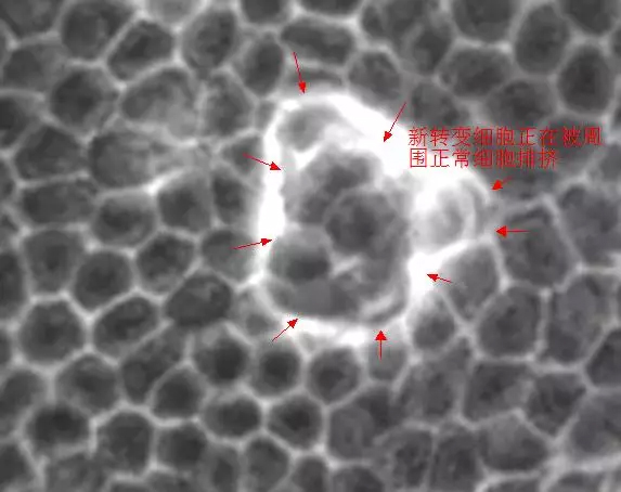 ã€ŠNatureã€‹ï¼šæ™®é€šç»†èƒžä¹Ÿå¯æ¸…é™¤ç™Œå˜ç»†èƒž