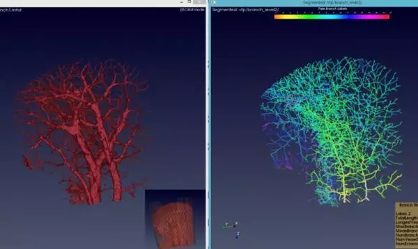 ä¸­å›½ç§‘å­¦å®¶å¼€å‘å‡ºå¯ç”¨äºŽæ—©æœŸè¯Šæ–­ç™Œç—‡çš„æ–°ç®—æ³•