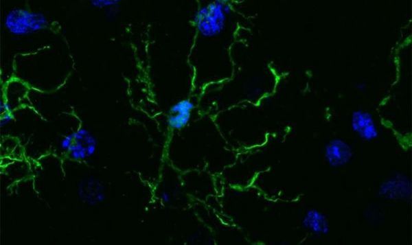 Scienceï¼šå¤§è„‘ä¸­å…ç–«ç»†èƒžæˆ–ä¸Žé˜¿å°”å…¹æµ·é»˜ç—…å‘ç”Ÿç›´æŽ¥å…³è”