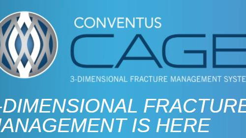 Conventus Orthopaedicsç ”å‘3Déª¨æŠ˜ä¿®å¤æ¤å…¥è®¾å¤‡ï¼šèŽ·2000ä¸‡ç¾Žå…ƒèžèµ„